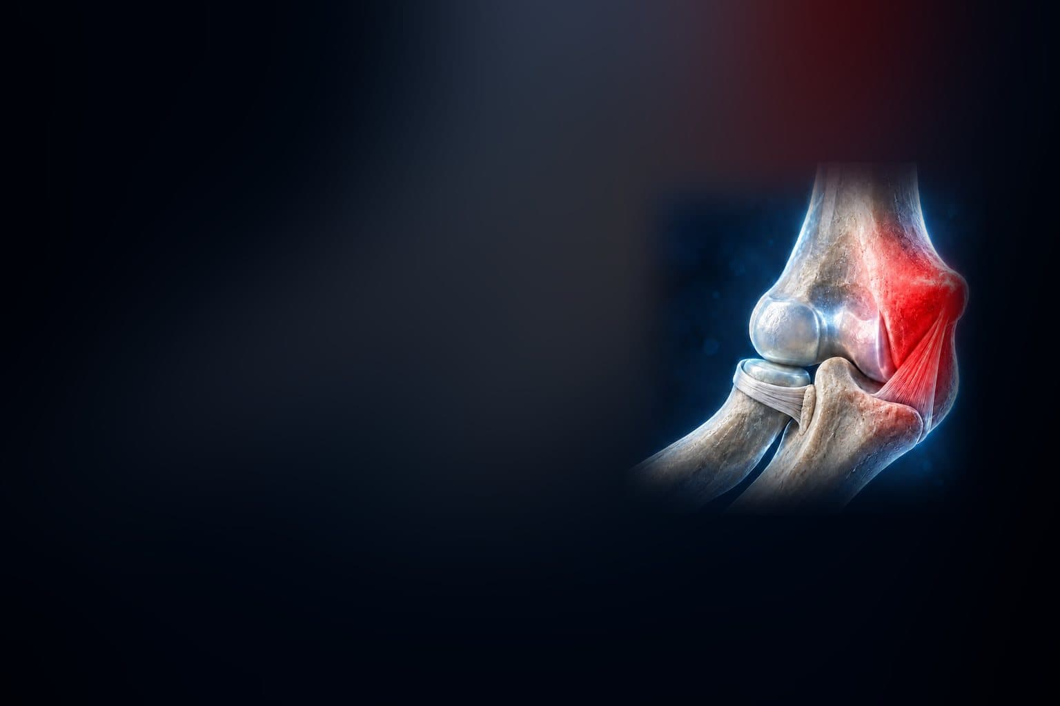 Stylised illustration of the elbow joint.