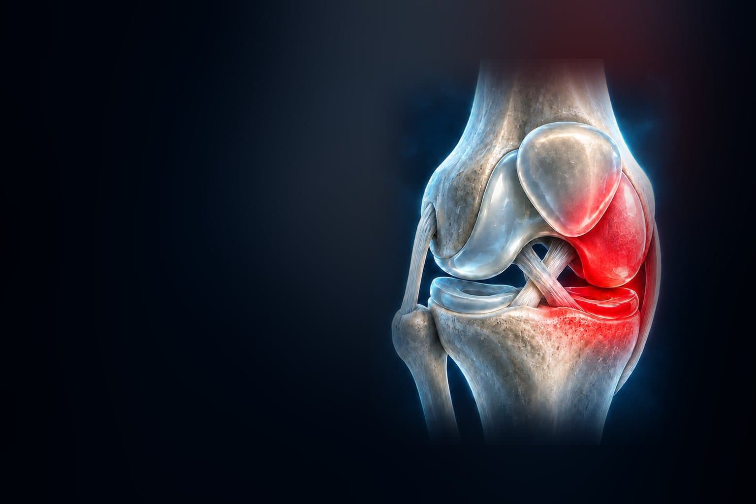 Illustration of the knee joint, with an area highlighted