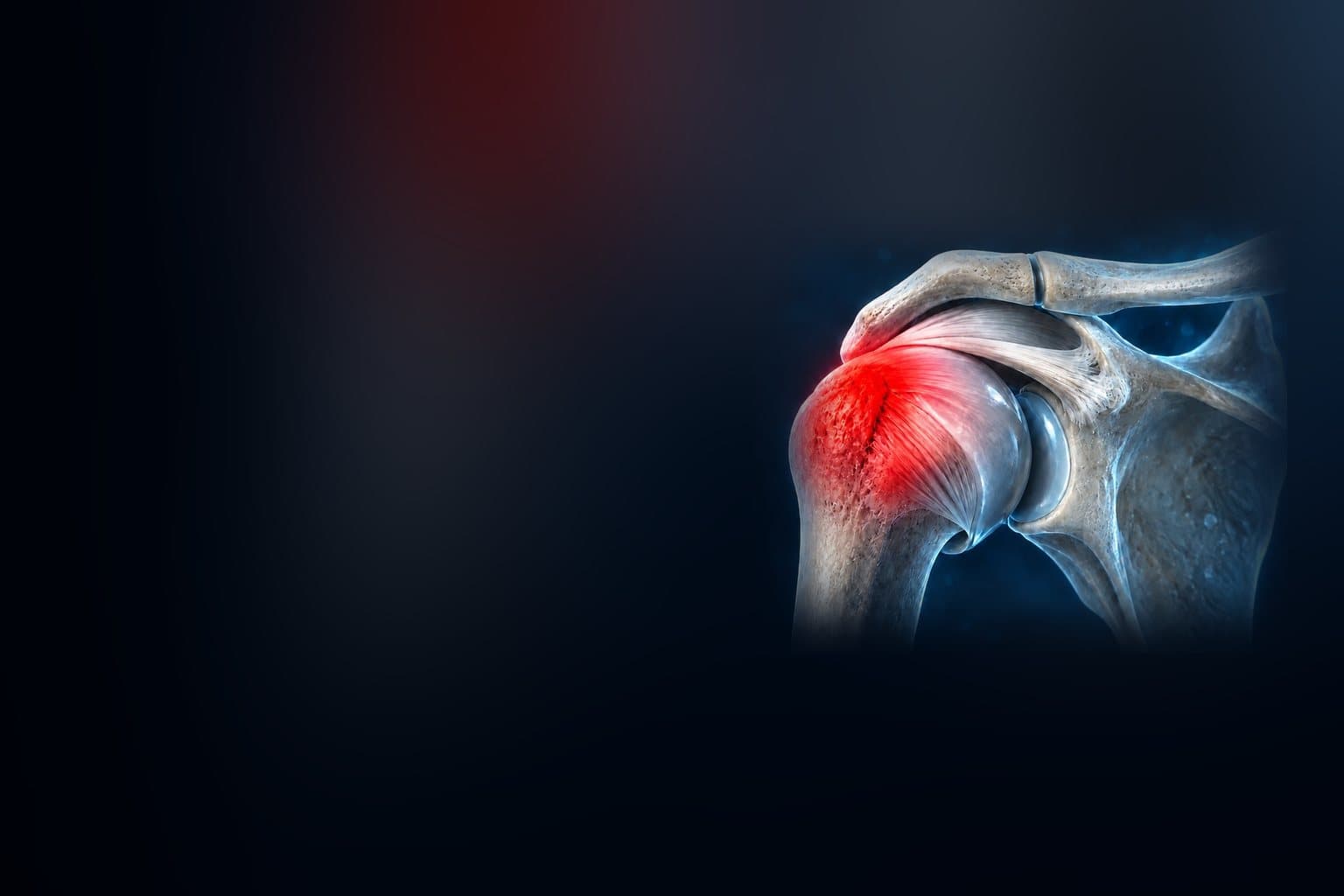 Stylised illustration of the shoulder joint.