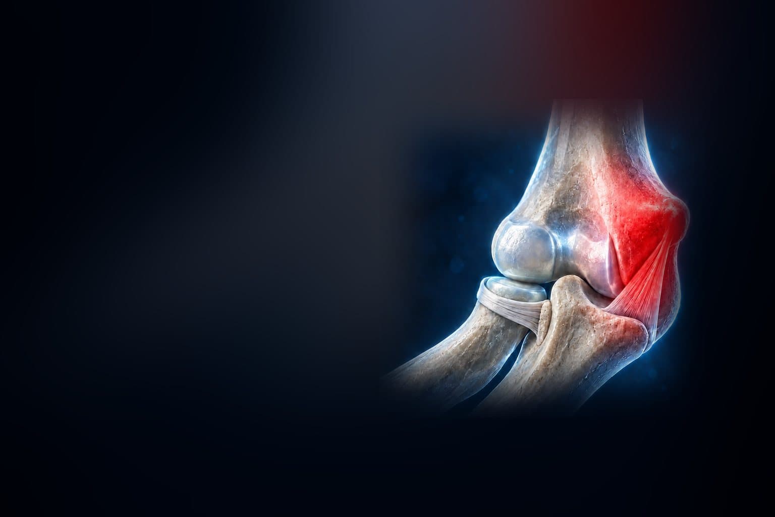 Illustration of the elbow joint, with an area highlighted