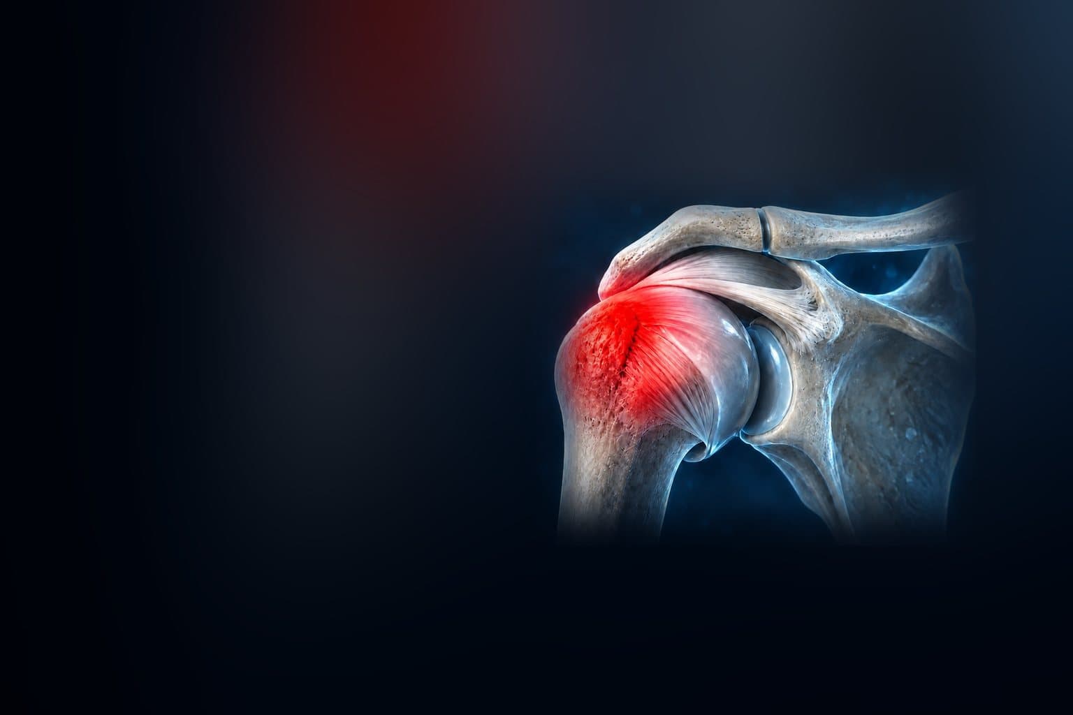 Illustration of the shoulder joint, with an area highlighted
